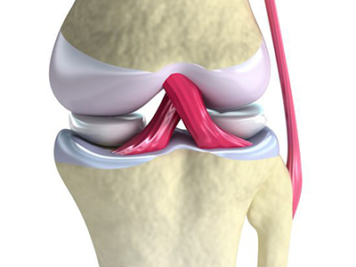 Lesoes-do-joelho-meniscos.png Lesoes-do-joelho-meniscos.png