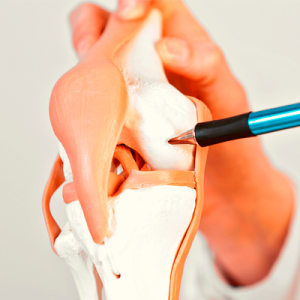 Lesões no joelho: A cartilagem articular