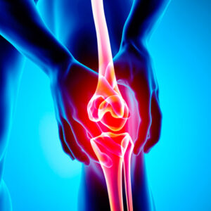 Instabilidade Articular